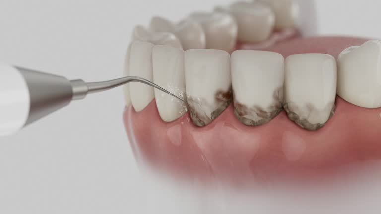 Trusted Dental Implants service in Bloomsburg, PA - Dentist Open Now